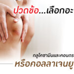 ปวดข้อเลือกอะไรดี